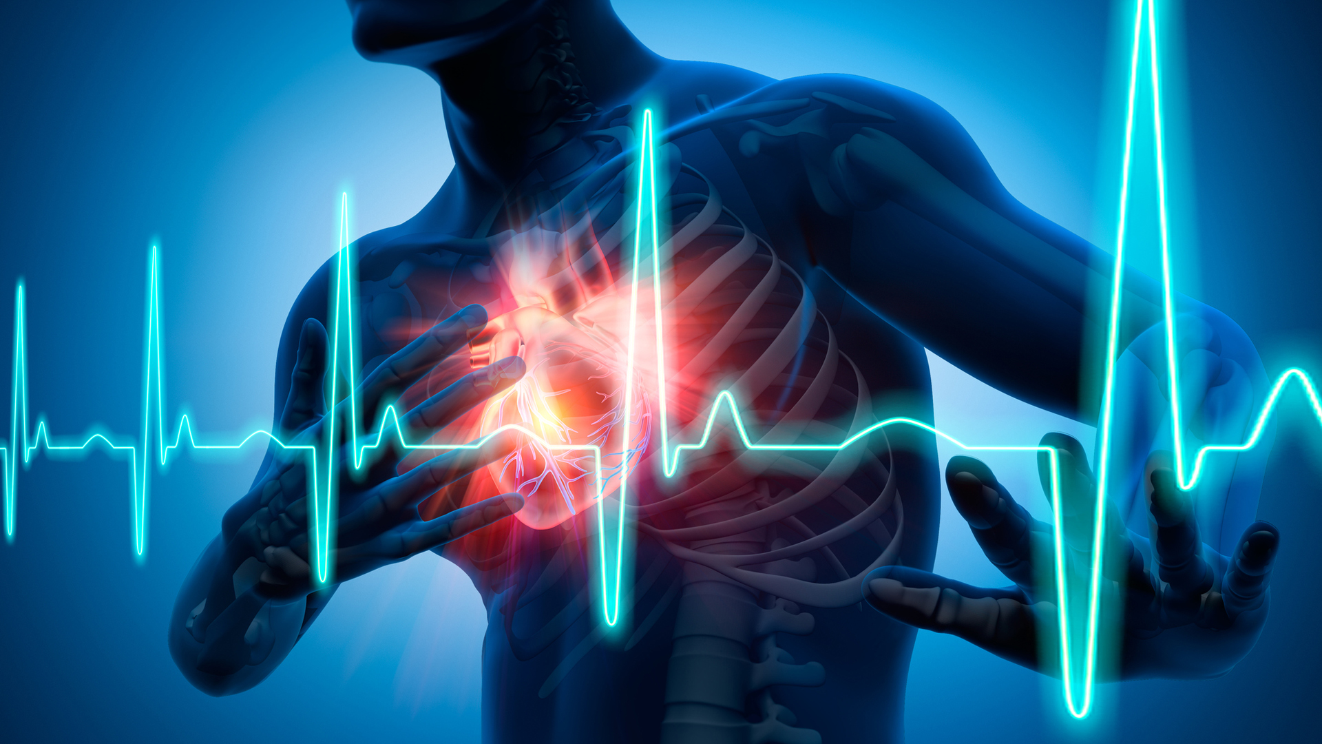CardioCare